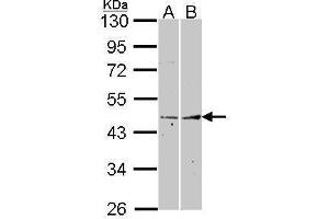 WB Image Sample (30 ug of whole cell lysate) A: A431 , B: Hela 10% SDS PAGE Fibromodulin antibody antibody diluted at 1:1000 (Fibromodulin 抗体)