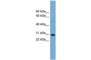WB Suggested Anti-Tgifx1 Antibody Titration:  0. (TGIF2LX 抗体  (Middle Region))