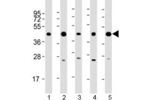 Western blot testing of human 1) 293T/17, 2) A431, 3) HeLa, 4) Jurkat and 5) K562 cell lysate with PHF6 antibody at 1:2000. (PHF6 抗体  (AA 315-349))