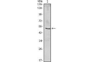 Western blot analysis using NFKBIB mouse mAb against Jurkat (1) cell lysate. (NFKBIB 抗体)