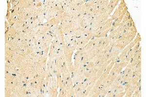 ABIN6263151 and ABIN6278130 at 1/100 staining Rat heart tissue by IHC-P. (MBNL1 抗体  (C-Term))