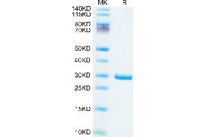 SARS-CoV-2 NSP7, NSP8 (AA 1-83) protein (His tag)