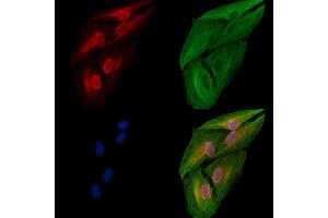 ABIN6258507 and ABIN6274710 staining  cells by IF/ICC. (EFTUD2 抗体  (N-Term))