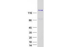 Western Blotting (WB) image for Amylo-alpha-1, 6-Glucosidase, 4-alpha-Glucanotransferase (AGL) (Transcript Variant 3) protein (Myc-DYKDDDDK Tag) (ABIN2714455)