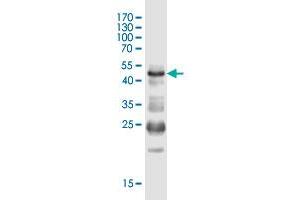 Western Blot detection against Immunogen (50. (IQCF1 抗体  (AA 1-205))