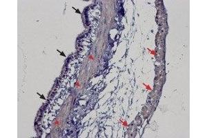 Immunohistochemistry (IHC) image for anti-Transient Receptor Potential Cation Channel, Subfamily M, Member 2 (TRPM2) (AA 105-120), (Intracellular) antibody (ABIN7043829)