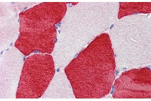 Immunohistochemistry (IHC) image for anti-Slow Skeletal Troponin I (TNNI1) (N-Term) antibody (ABIN2777151)