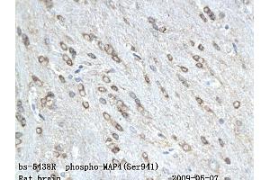 Formalin-fixed and paraffin embedded rat colitis labeled with Anti-phospho-MAP4(Ser941) Polyclonal Antibody, Unconjugated (ABIN802068) followed by conjugation to the secondary antibody and DAB staining (MAP4 抗体  (pSer941))