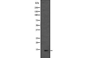 Western blot analysis of L36mt expression in HEK293 cells ,The lane on the left is treated with the antigen-specific peptide. (MRPL36 抗体  (Internal Region))