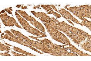 Detection of MMP9 in Mouse Cardiac Muscle Tissue using Polyclonal Antibody to Matrix Metalloproteinase 9 (MMP9)