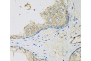 Immunohistochemistry of paraffin-embedded Human prostate using LLGL2 Polyclonal Antibody at dilution of 1:200 (40x lens). (LLGL2 抗体)