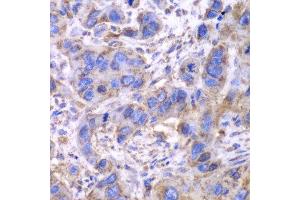 Immunohistochemistry (Paraffin-embedded Sections) (IHC (p)) image for anti-Succinate Dehydrogenase Complex, Subunit A, Flavoprotein (Fp) (SDHA) (AA 385-664) antibody (ABIN3023400)