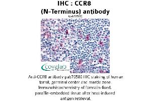 Image no. 1 for anti-Chemokine (C-C Motif) Receptor 8 (CCR8) (Extracellular Domain), (N-Term) antibody (ABIN1732786) (CCR8 抗体  (Extracellular Domain, N-Term))