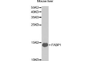 Western blot analysis of extracts of mouse liver, using FABP1 antibody (ABIN5973056) at 1/1000 dilution. (FABP1 抗体)