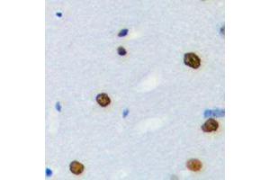 Immunohistochemical analysis of hnRNP LL staining in human brain formalin fixed paraffin embedded tissue section. (HNRPLL 抗体  (Center))