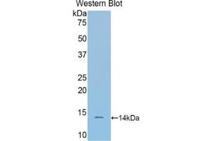 Western blot analysis of the recombinant protein. (SFRP4 抗体  (AA 167-260))