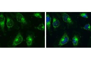 ICC/IF Image AMPK alpha 2 antibody detects AMPK alpha 2 protein at cytoplasm and nucleus by immunofluorescent analysis.