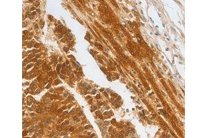 Immunohistochemistry (IHC) image for anti-Complement Factor H-Related 1 (CFHR1) antibody (ABIN1871806) (CFHR1 抗体)