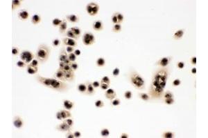 IHC testing of FFPE human SW480 cells with EIF3A antibody. (EIF6 抗体  (AA 66-210))