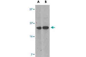 Western blot analysis of MARVELD1 in mouse heart tissue lysate with MARVELD1 polyclonal antibody  at (A) 1 and (B) 2 ug/mL . (MARVELD1 抗体  (N-Term))