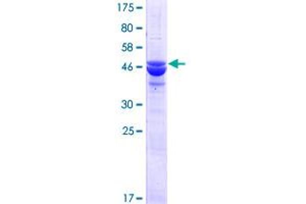 N6AMT2 Protein (AA 1-214) (GST tag)