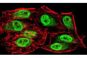 Immunofluorescence analysis of HeLa cells using SIRT6 mouse mAb (green). (SIRT6 抗体  (AA 141-250))
