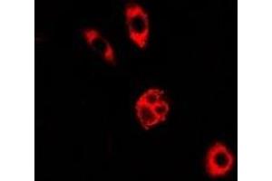 Immunofluorescent analysis of GALE staining in A549 cells. (GALE 抗体)