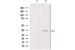 Western Blotting (WB) image for anti-ATP Synthase, H+ Transporting, Mitochondrial F1 Complex, gamma Polypeptide 1 (ATP5C1) (Internal Region) antibody (ABIN6257083)