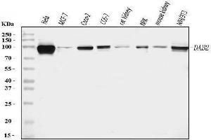 Western blot analysis of DAB2 using anti-DAB2 antibody (ABIN7602613).