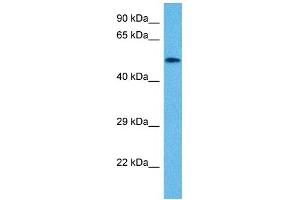 Host:  Mouse  Target Name:  VIM  Sample Tissue:  Mouse Small Intestine  Antibody Dilution:  1ug/ml (Vimentin 抗体  (N-Term))