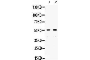 Western blot analysis of XRCC4 expression in SW620 whole cell lysates (lane 1) and A431 whole cell lysates (lane 1).