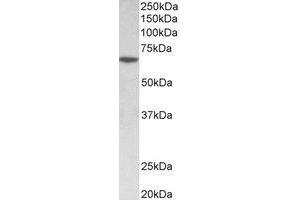 Western Blotting (WB) image for anti-SRY (Sex Determining Region Y)-Box 11 (SOX11) (Internal Region) antibody (ABIN2464999) (SOX11 抗体  (Internal Region))