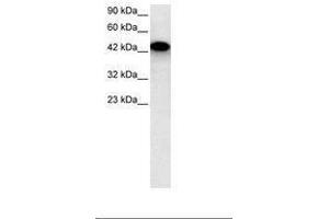 Image no. 2 for anti-Eyes Absent Homolog 3 (EYA3) (AA 277-326) antibody (ABIN6735802) (EYA3 抗体  (AA 277-326))