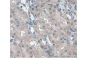 Detection of a1AGP in Rat Kidney Tissue using Monoclonal Antibody to Alpha-1-Acid Glycoprotein (a1AGP) (ORM1 抗体  (AA 20-186))