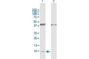 Western Blot analysis of CCL14 expression in transfected 293T cell line by CCL14 MaxPab polyclonal antibody. (CCL14 抗体  (AA 1-93))