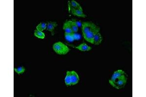Immunofluorescent analysis of MCF-7 cells using ABIN7164439 at dilution of 1:100 and Alexa Fluor 488-congugated AffiniPure Goat Anti-Rabbit IgG(H+L) (Midline 2 抗体  (AA 506-735))