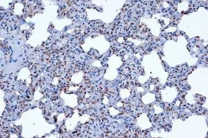 Immunohistochemistry of paraffin-embedded rat lung using JunD Rabbit mAb (ABIN7268051) at dilution of 1:100 (40x lens). (JunD 抗体)