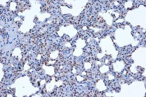 Immunohistochemistry of paraffin-embedded rat lung using JunD Rabbit mAb (ABIN7268051) at dilution of 1:100 (40x lens).
