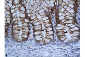 Image no. 1 for anti-Suppressor of Variegation 3-9 Homolog 1 (Drosophila) (SUV39H1) (C-Term) antibody (ABIN202465) (SUV39H1 抗体  (C-Term))