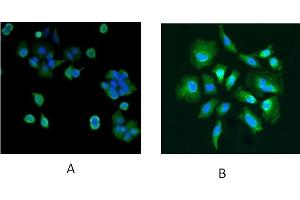 Immunofluorescence staining of MCF7 (A) and Hela (B) cells with 5 μg/mL (ABIN184951) antibody.