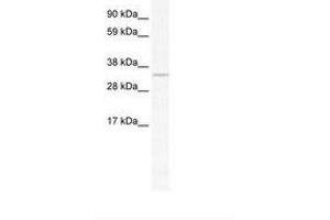 Image no. 1 for anti-Apurinic/Apyrimidinic Endonuclease 1 (APEX1) (AA 21-70) antibody (ABIN202227) (APEX1 抗体  (AA 21-70))