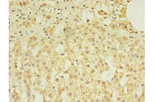 Immunohistochemistry of paraffin-embedded human adrenal gland tissue using ABIN7173349 at dilution of 1:100 (TREML2 抗体  (AA 19-268))