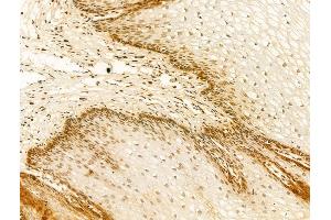 ABIN7094280 and ABIN7098327 at 1/100 staining Human normal tissues adjacent to esophageal cancer by IHC-P.