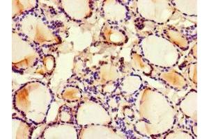 Immunohistochemistry of paraffin-embedded human thyroid tissue using ABIN7159100 at dilution of 1:100 (MED1 抗体  (AA 878-1031))