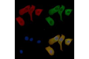 CTNNAL1 Mouse Monoclonal Antibody staining Hela cells by IF/ICC. (CTNNAL1 抗体  (Internal Region))