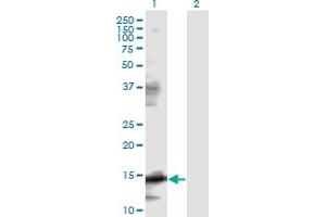 Western Blot analysis of EIF5A expression in transfected 293T cell line by EIF5A monoclonal antibody (M01), clone 8C1. (EIF5A 抗体  (AA 1-154))
