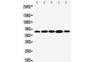 Anti-Bag3 antibody, Western blotting Lane 1: MCF-7 Cell Lysate Lane 2: JURKAT Cell Lysate Lane 3: A549 Cell Lysate Lane 4: HELA Cell Lysate Lane 5: COLO320 Cell Lysate (BAG3 抗体  (C-Term))