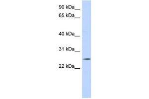 WB Suggested Anti-NKAIN4 Antibody Titration: 0. (NKAIN4 抗体  (Middle Region))