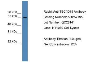 WB Suggested Anti-TBC1D19  Antibody Titration: 0. (TBC1D19 抗体  (Middle Region))