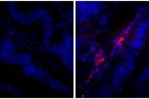 Paraffin embedded human gastric cancer tissue was stained with Rabbit IgG-UNLB isotype control and DAPI. (兔 anti-人 IgG Antibody (Alkaline Phosphatase (AP)))